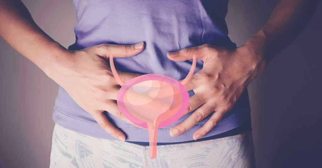 Person in purple shirt holding lower abdomen with an illustration of a bladder superimposed, indicating urinary or bladder health.